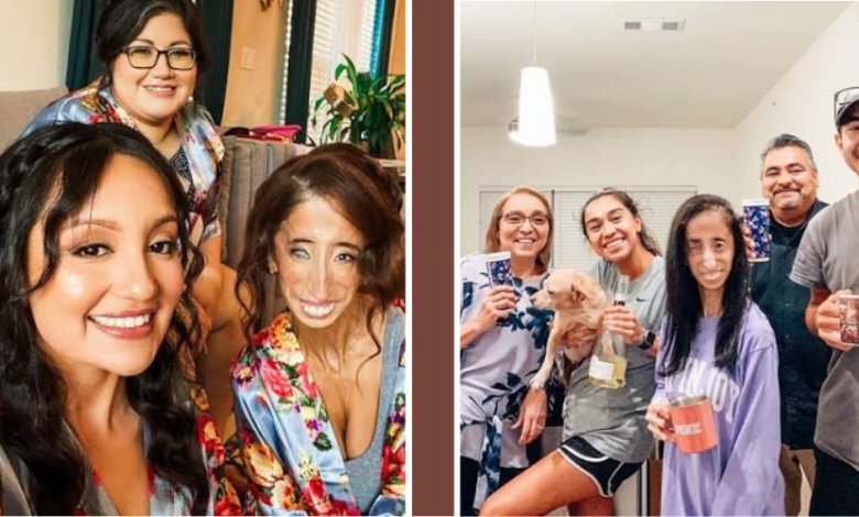 Is Lizzie Velasquez Married? Husband, Family, Age and Net Worth